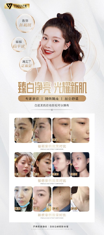 留纤减肥原理