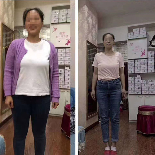 产后瘦肚子腰围小了7公分