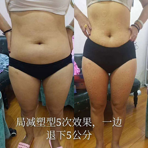 留纤腹部局减效果就是好